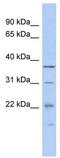Malignant T cell-amplified sequence 1 antibody, TA343797, Origene, Western Blot image 
