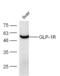 Glucagon-like peptide 1 receptor antibody, GTX17604, GeneTex, Western Blot image 