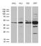 Ribonucleoside-diphosphate reductase subunit M2 antibody, TA810467, Origene, Western Blot image 