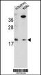 Ring Finger Protein 185 antibody, 55-442, ProSci, Western Blot image 