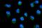 Mitochondrially Encoded NADH:Ubiquinone Oxidoreductase Core Subunit 6 antibody, A03777-2, Boster Biological Technology, Immunofluorescence image 