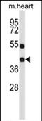 Deltex E3 Ubiquitin Ligase 3 antibody, PA5-71816, Invitrogen Antibodies, Western Blot image 
