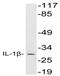 Interleukin 1 Beta antibody, AP20628PU-N, Origene, Western Blot image 