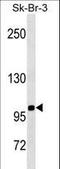 Sialophorin antibody, LS-C161463, Lifespan Biosciences, Western Blot image 