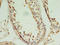 PIN1 antibody, A60278-100, Epigentek, Immunohistochemistry paraffin image 
