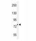 Lysine Demethylase 2B antibody, F40092-0.4ML, NSJ Bioreagents, Western Blot image 