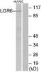 Leucine Rich Repeat Containing G Protein-Coupled Receptor 6 antibody, TA313244, Origene, Western Blot image 