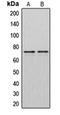 DM1 Protein Kinase antibody, orb213855, Biorbyt, Western Blot image 