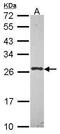 Ubiquitin Conjugating Enzyme E2 K antibody, PA5-30058, Invitrogen Antibodies, Western Blot image 