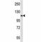 Proprotein Convertase Subtilisin/Kexin Type 6 antibody, F44208-0.4ML, NSJ Bioreagents, Western Blot image 