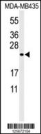 Zinc Finger CCHC-Type Containing 24 antibody, MBS9205604, MyBioSource, Western Blot image 