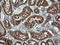 Acetyl-CoA Acyltransferase 2 antibody, LS-C338051, Lifespan Biosciences, Immunohistochemistry paraffin image 