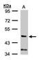 Phosphoinositide-3-Kinase Regulatory Subunit 3 antibody, orb74206, Biorbyt, Western Blot image 