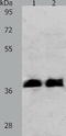 Ring Finger Protein 126 antibody, TA321979, Origene, Western Blot image 