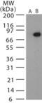 Bacillus anthracis Protective Antigen antibody, NB120-13808, Novus Biologicals, Western Blot image 