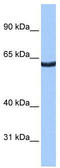 Zinc Finger Protein 350 antibody, TA339534, Origene, Western Blot image 