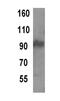 TPX2 Microtubule Nucleation Factor antibody, GTX79474, GeneTex, Western Blot image 