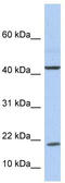 Interleukin 9 antibody, TA336228, Origene, Western Blot image 
