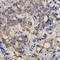 Chloride Voltage-Gated Channel 5 antibody, LS-C334230, Lifespan Biosciences, Immunohistochemistry paraffin image 