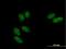 SSU72 Homolog, RNA Polymerase II CTD Phosphatase antibody, H00029101-B01P, Novus Biologicals, Immunofluorescence image 