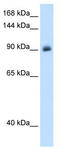 Mineralocorticoid receptor antibody, TA338357, Origene, Western Blot image 