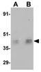 Homeobox protein ESX1 antibody, GTX85009, GeneTex, Western Blot image 