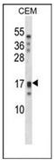 Kallikrein Related Peptidase 15 antibody, AP52393PU-N, Origene, Western Blot image 