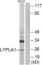 Lysophospholipase 1 antibody, LS-C119696, Lifespan Biosciences, Western Blot image 