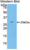 Protein Kinase AMP-Activated Non-Catalytic Subunit Gamma 2 antibody, LS-C296124, Lifespan Biosciences, Western Blot image 