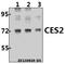 Cocaine esterase antibody, A02868, Boster Biological Technology, Western Blot image 