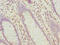 Hyaluronan-binding protein 2 antibody, A50688-100, Epigentek, Immunohistochemistry paraffin image 