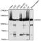 Minichromosome Maintenance Complex Component 3 antibody, 13-753, ProSci, Immunohistochemistry paraffin image 