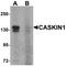 CASK Interacting Protein 1 antibody, LS-B8854, Lifespan Biosciences, Western Blot image 