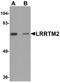 Leucine-rich repeat transmembrane neuronal protein 2 antibody, A11486, Boster Biological Technology, Western Blot image 