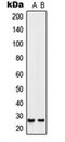 Homeobox protein SIX6 antibody, orb214347, Biorbyt, Western Blot image 