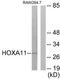 Homeobox A11 antibody, TA314027, Origene, Western Blot image 