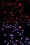 Hdm2 antibody, LS-C335767, Lifespan Biosciences, Immunofluorescence image 
