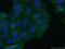 ITGB6 antibody, 19695-1-AP, Proteintech Group, Immunofluorescence image 