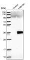 3-hydroxyisobutyrate dehydrogenase, mitochondrial antibody, NBP1-80985, Novus Biologicals, Western Blot image 