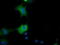 Quinolinate Phosphoribosyltransferase antibody, TA501526, Origene, Immunofluorescence image 