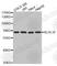 Kelch Like Family Member 18 antibody, A3390, ABclonal Technology, Western Blot image 