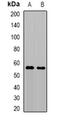 TRNA Methyltransferase 61B antibody, abx141454, Abbexa, Western Blot image 
