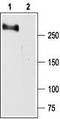 Sodium Voltage-Gated Channel Alpha Subunit 2 antibody, TA329028, Origene, Western Blot image 
