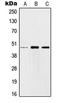 Jun Proto-Oncogene, AP-1 Transcription Factor Subunit antibody, LS-C352431, Lifespan Biosciences, Western Blot image 