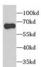 Gamma-PAK antibody, FNab06122, FineTest, Western Blot image 