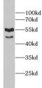 CD55 Molecule (Cromer Blood Group) antibody, FNab10514, FineTest, Western Blot image 