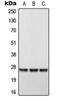 Dehydrogenase/Reductase 2 antibody, orb214970, Biorbyt, Western Blot image 