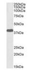 Laforin antibody, orb389364, Biorbyt, Western Blot image 