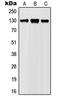 Janus Kinase 1 antibody, GTX55099, GeneTex, Western Blot image 