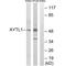 Lysophosphatidylcholine Acyltransferase 2 antibody, A07471, Boster Biological Technology, Western Blot image 